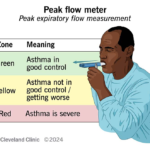 Asthme pollinique