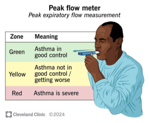 Lire la suite à propos de l’article Asthme pollinique